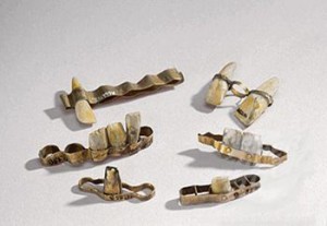 的伊特鲁里亚,他早于罗马人,练习制作假牙和植入早在公元前7世纪。他们用金线,金带,在错综复杂的牙科和金色铆钉。